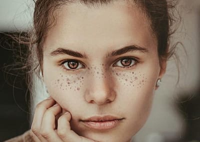 young white woman with freckles